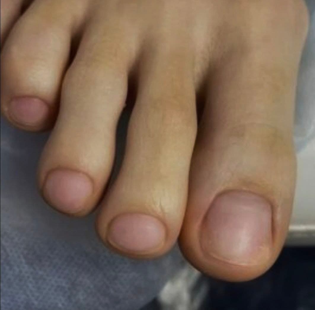 Мужской педикюр — пример работы в салоне Педикюр, Ставрополь